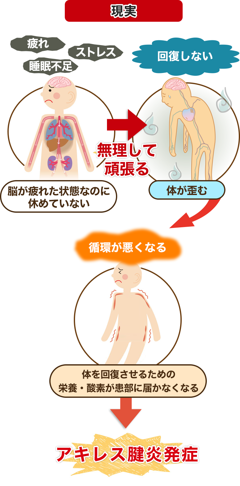 現実 間接的な原因