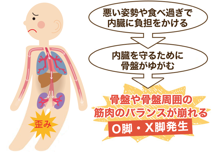 内臓疲労や姿勢が原因のO脚・X脚