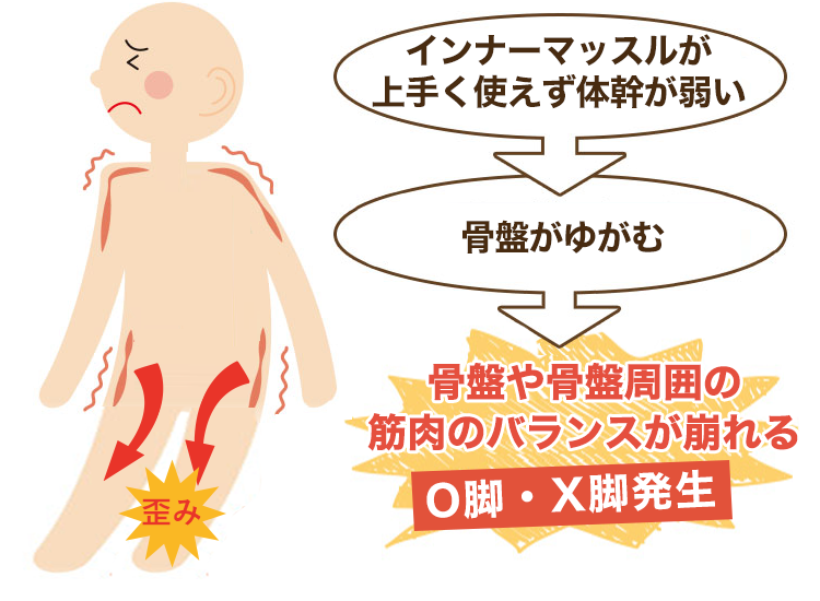 体幹バランスや骨盤インナーマッスルが原因のO脚・X脚
