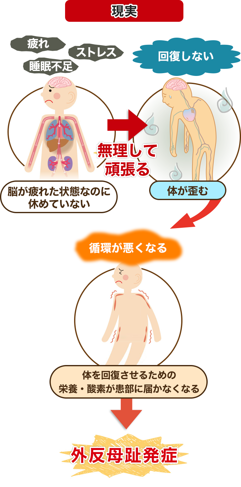 現実 間接的な原因