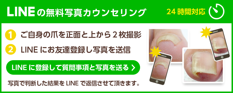 LINE＠無料カウンセリング