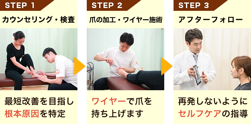八王子足改善センターの施術の流れ