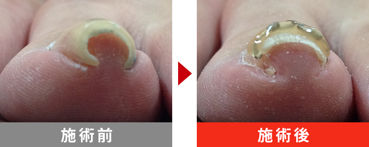 初回でここまで改善！