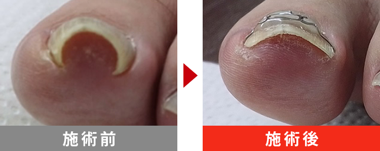 初回でここまで改善！