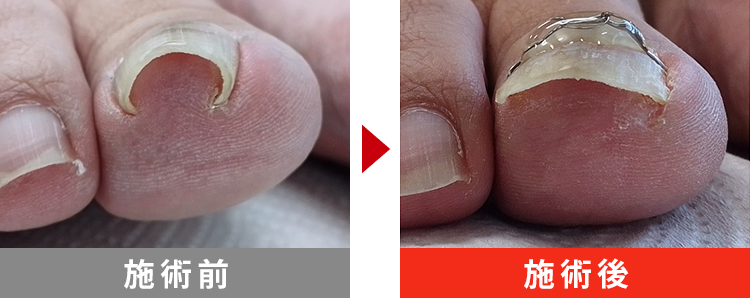 初回でここまで改善！