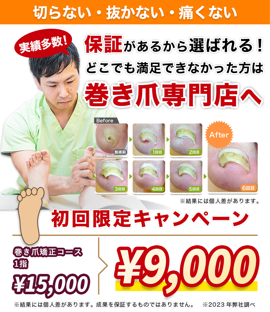 実績多数。保証があるから選ばれる！どこでも満足できなかった方は巻き爪専門店へ