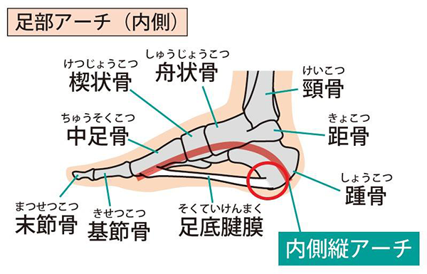 足底筋膜炎（足底腱膜炎）とは？