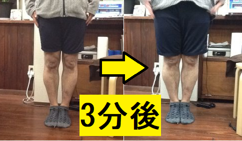 たった３分の施術でふくらはぎがついた！
