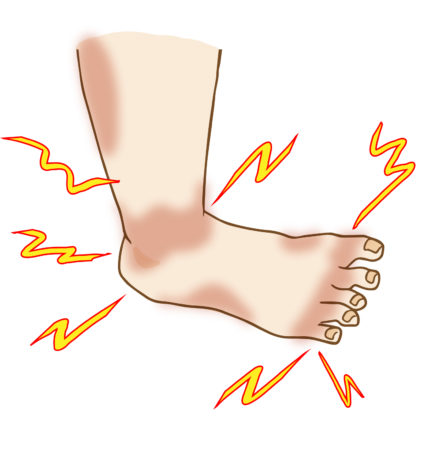 なんで？指の付け根の痛み