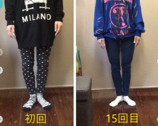 足のバランスが気になっていた主婦のＫさん