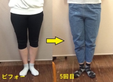下半身太りも改善するＯ脚矯正