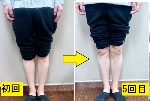 男性でも5回でこの効果！