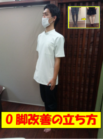 O脚改善のための立ち方
