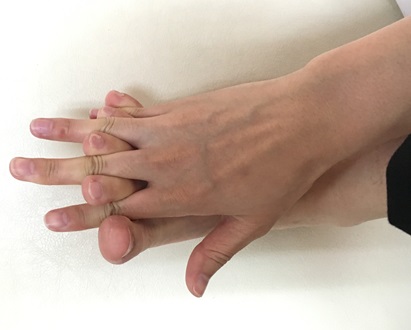 巻き爪の方必見。自宅で簡単にできるグーパー体操‼