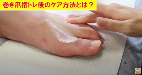 巻き爪予防のための指トレ後のケア方法をご紹介