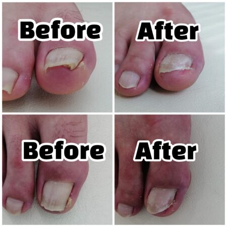 爪もよくなりました！