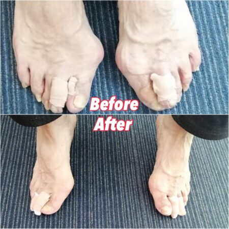 今まで足の事で一人で悩んできました・・・