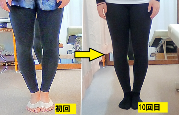 初回から10回目のビフォーアフター