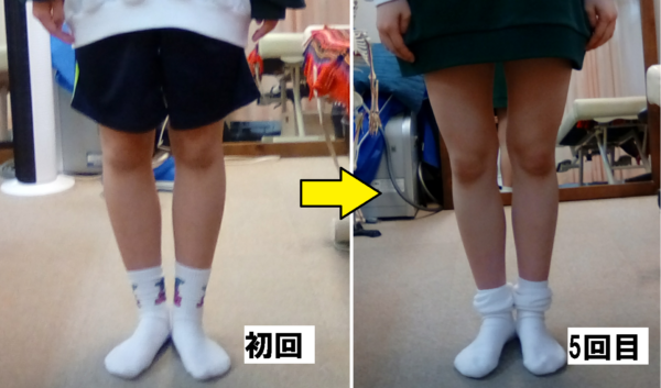 初回から回目のビフォーアフター