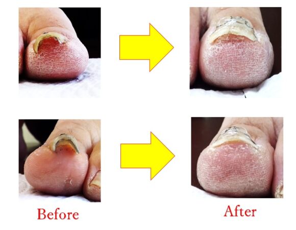 ズキズキとした痛みが1回目の矯正で楽になりました(^^)/