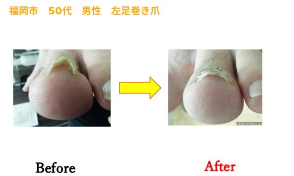 営業職で歩くのも痛かったのが１回の施術で痛みはなくなりました。