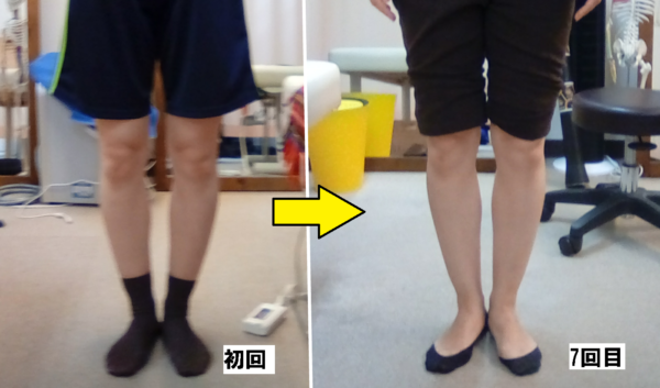 初回から7回目のビフォーアフター