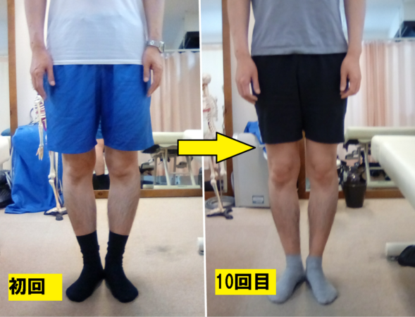 初回から10回目のビフォーアフター③
