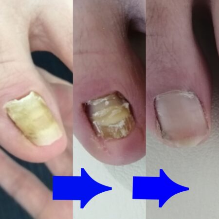 爪だけでなく身体の施術もして頂きました