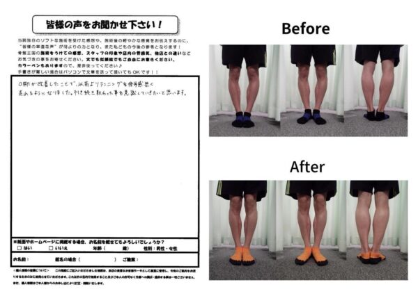 O脚が改善したことでランニングの疲労感がなくなりました