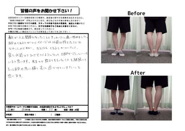 だんだんO脚が改善していくのがわかりました！