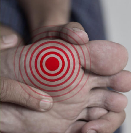 魚の目の成因と対策：足の健康を守るために