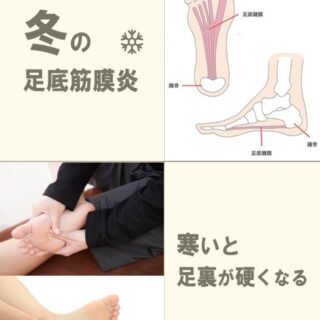❄️寒いと足裏が硬くなる？冬の足底筋膜炎に気をつけろ