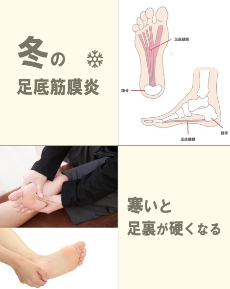❄️寒いと足裏が硬くなる？冬の足底筋膜炎に気をつけろ