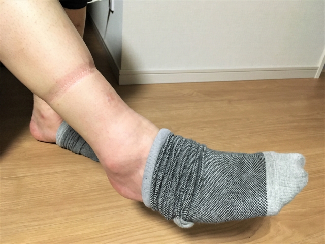足のむくみは、歩けば改善するとは限りません